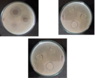 The Effect of Silver Oxide Nanoparticles on the Antibacterial Property and Shear Bond Strength of Dental Composite