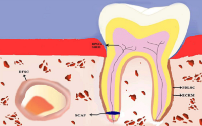 Efficacy of Scaffolds with/without Stem Cells on Dogsâ€™Class II and III Furcation Defects: Systematic Review