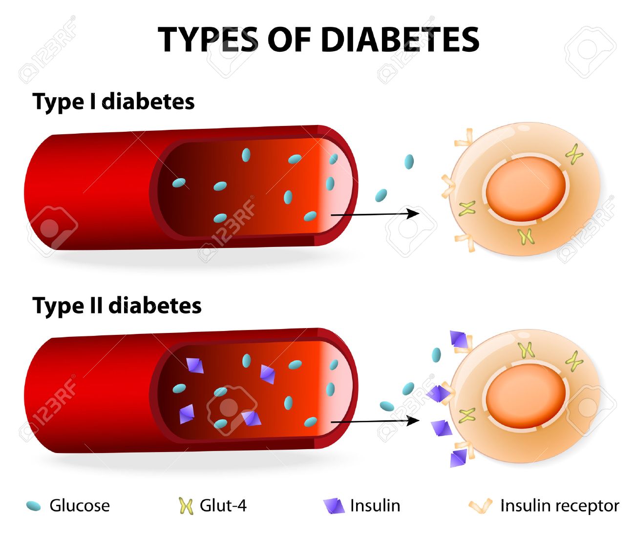 Awareness Regarding Ramadan and Diabetes Mellitus, in Health Care Providers of Services Hospital Lahore