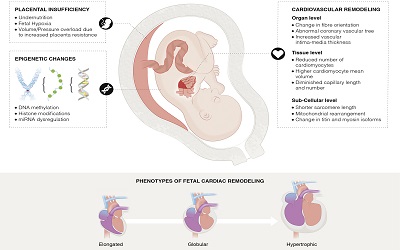 Fetal Growth Restriction, Endocrine and Cardiovascular Disorders