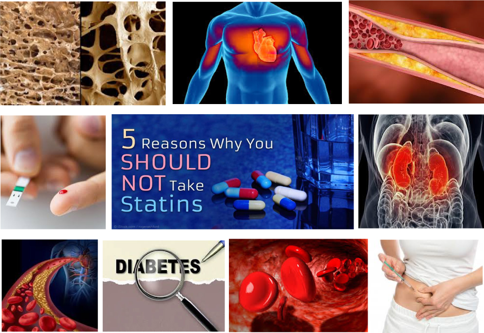 Statins Cause Lifestyle-Related Diseases-Biochemical Mechanism