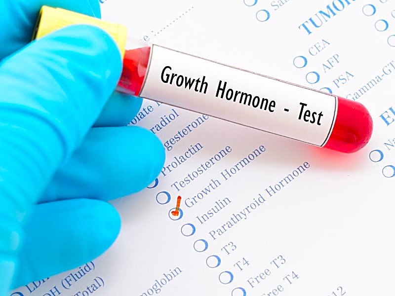 Growth Hormone Stimulation Test: Results and Predictive Factors