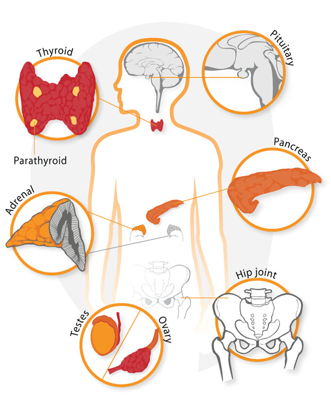 World Summit on Interventional Therapies for Diabetes and Multidisciplinary Medicine (Market Analysis for Diabetes Summit 2020)