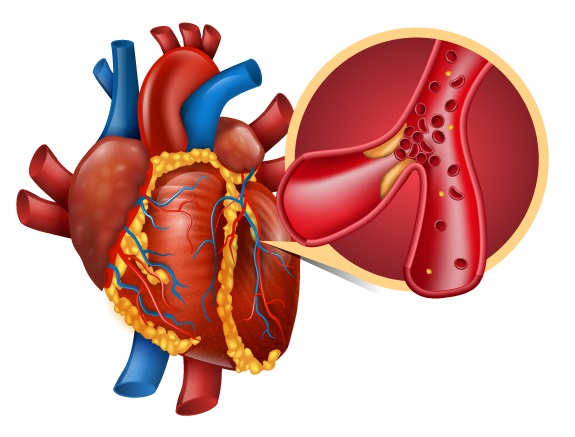 Experiences of Acute Myocardial Infarction Survivors: A Qualitative Research