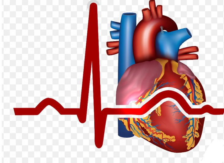 Trends in Hospitalization Rates for A First Myocardial Infarction In New Jersey 2000-2014