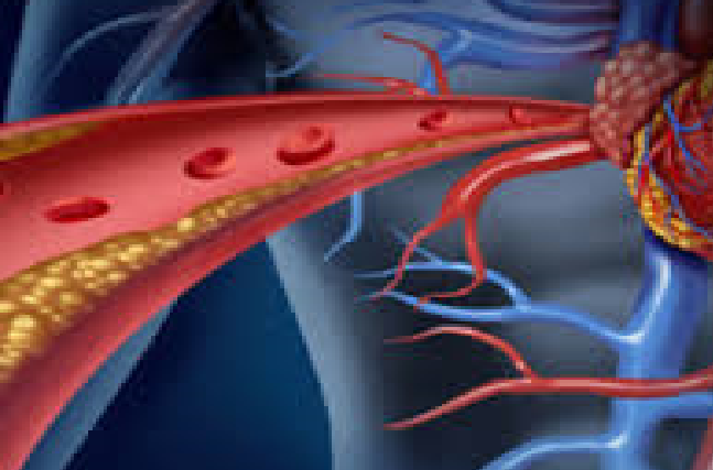 Clinically Diagnosed Homozygous Familial Hypercholesterolemia-rare entity