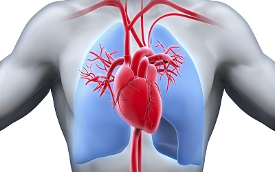 Acute Right Ventricular Failure and Pulmonary Hypertension Secondary to Acute on Chronic
Pulmonary Thromboembolic Disease