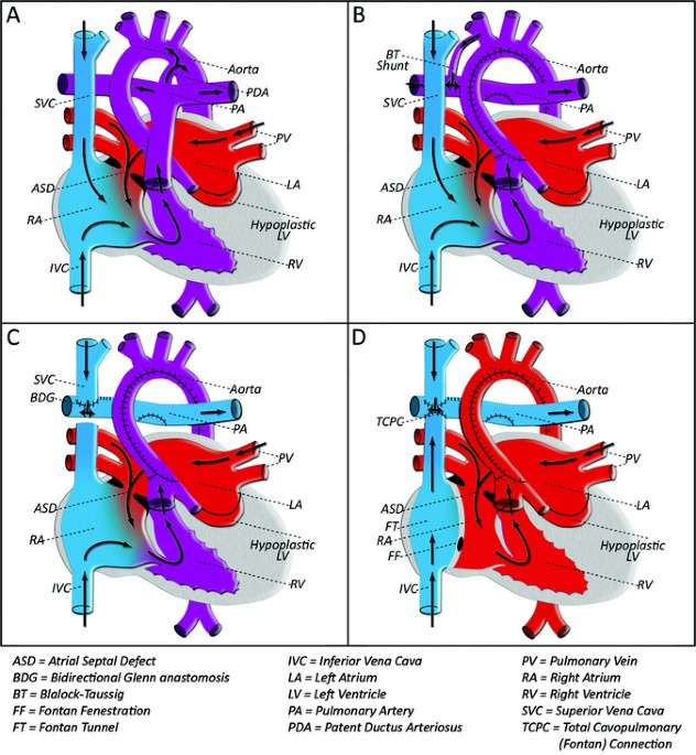 Serum Neuron Specific Enolase use in Detecting Brain Injury in Children with Congenital Heart Disease before Undergoing Cardiac Surgery