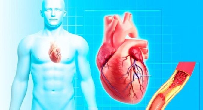 Comparing Two Kinds of Prime Solution between Ringer/Albumin and Ringer Lactate/Gelatin for
Patients Undergoing
Cardiopulmonary Bypass