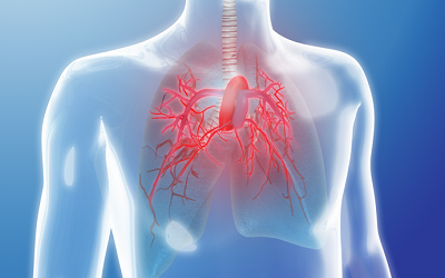 Pulmonary Hypertension in Patients Undergoing Kidney Transplant - A Single Center
Experience