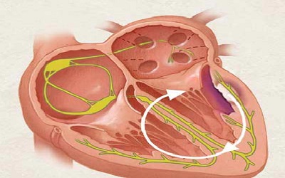 Amiodarone-Induced Life- Threatening Ventricular Arrhythmias in a Patient with Cerebrogenic QT Interval Prolongation. Clinical Implications