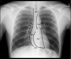 Cardiovascular Diagnostic Imaging and Treatment Methods