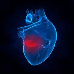 Seizure in the Scenario of an Acute Myocardial Infarction: A Case Report