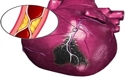 Administration of a Synthetic Peptide Derived from the E-domain Region of Mechano-Growth Factor Delays Decompensation Following Myocardial Infarction