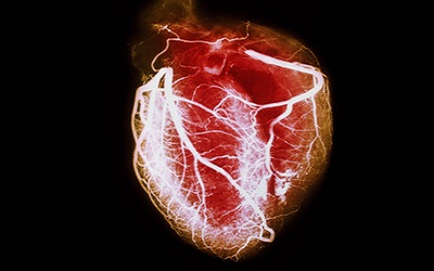 Pattern of Heart Failure in an Adult Kenyan Population