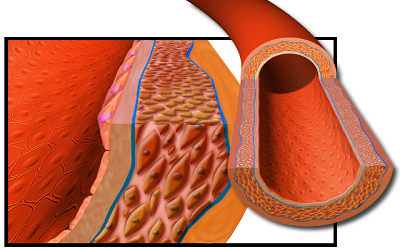 Association of Contrast Medium Arrival Time with Conventional Risk Factors and Morise Score in Detecting Obstructive Coronary Artery Disease