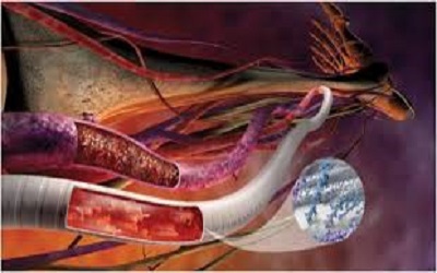 Determination of the Accuracy of
Ultrasound for Detecting Stenosis
in Tissue Engineered Vascular
Grafts in a Murine Model