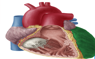 Catheter Ablation of Automatic
Left Ventricular Purkjnie
Tachycardia in Patient without
Heart Disease