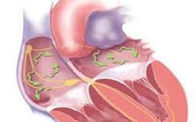 Systematic Review of Atrial Fibrillation in Patients with Chronic Kidney Disease: Prevalence, Incidence, Morbidity and Mortality