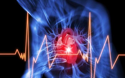 Sudden Cardiac Death is not Caused by Ischemia