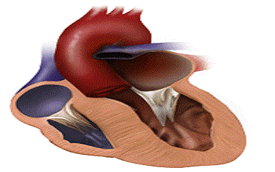 Dynamic Left Ventricular Outflow Tract Obstruction: Comparison between Dobutamine and Exercise Stress-Echo