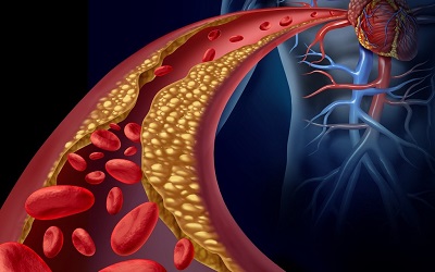 A Systematic Review of Lipid Measures and Lipid Ratios of Five Continents Populations, Estimation of Ratios and Standard Lipid Indices for Atherosclerosis: Persian Study