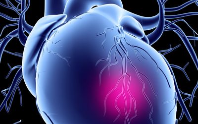 Is C-reactive Protein Related to Cardiovascular Risk Factors in Brazilian Patients undergoing Coronary Angiography?