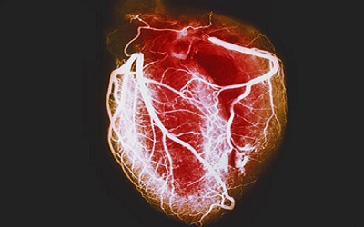 Congenital Absence of Pulmonary Valve: A Rare Congenital Heart Defect in Newborns