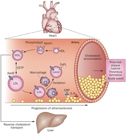 Human Pericoronary Adipose Tissue as Storage and Possible Supply Site for Lipoproteins in Atherosclerotic Coronary Plaques