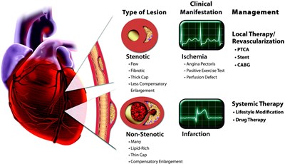 Coronary Artery Disease Risk Factors among Females in a Tertiary Cardiac Center in Nepal: A Case Control Study