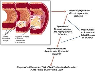 Prevalence of Heart Disease among Asymptomatic Chronic Type 2 Diabetic Patients