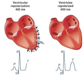 Ventricular Repolarization in Patients with Decompensated Liver Cirrhosis and its Relation to the in-Hospital Outcome: Electrocardiographic Study