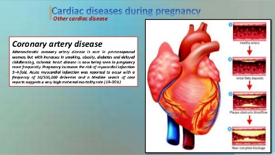 Pregnancy with Heart Diseases in Egypt: Spectrum and Outcome