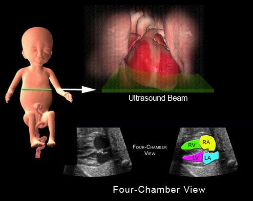 Echocardiographic Study of Paediatrics Patients in a Private Hospital in an Urban City in Nigeria