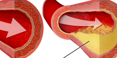 Quantitative Coronary Angiography for Assessment of Non-Obstructive Coronary Artery Disease: Comparison to Fractional Flow Reserve