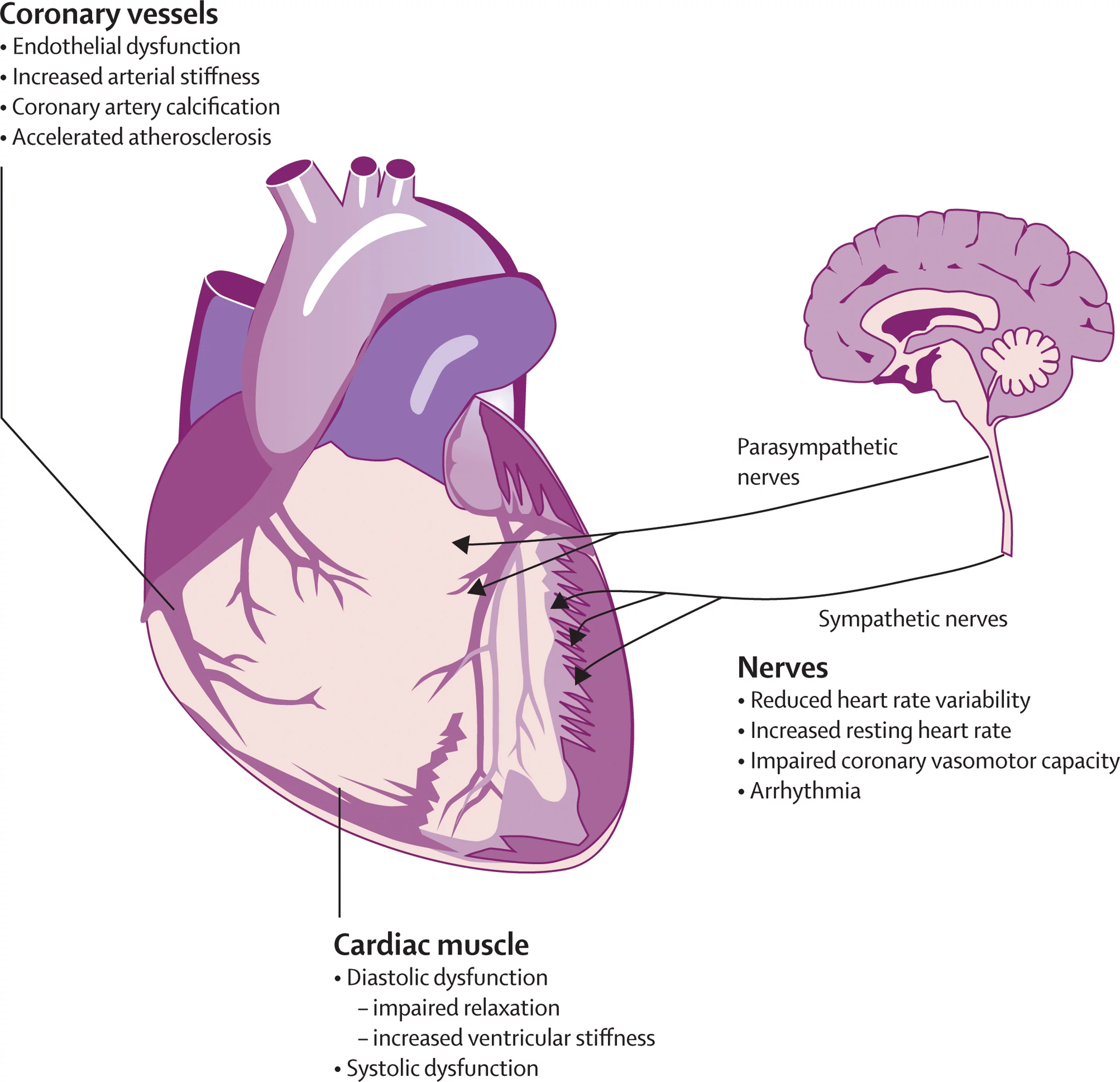 Macrophage Migration Inhibitory Factor Gene Polymorphisms (MIF-173CC) Genotyping in Patients with Cardiac Dysfunction: Relationship to Diabetes Mellitus