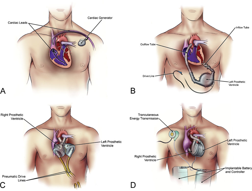 In vitro Hemocompatibility Testing of Dyneema Purity® Fibers Patch and Clinically Used Cardiovascular Prostheses