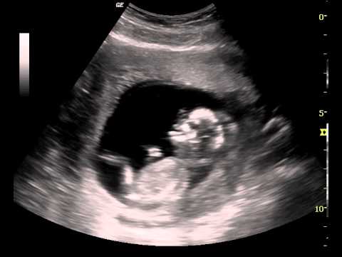 Socioeconomic Correlates of Use Long-Acting Contraceptive Methods Among Women of Reproductive Age in Guto Gida District, East Wollega Zone, Oromia, Ethiopia