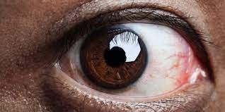 The Impact of Human Microbiota in Ocular Inflammation