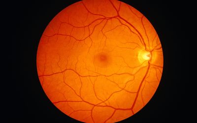 Treatment of Macular Edema Secondary to Retinal Vein Occlusion with Ranibizumab or Dexamethasone - Preliminary Results