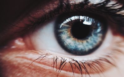 Amantadine Corneal Toxicity:Case Report and Review of the Literature