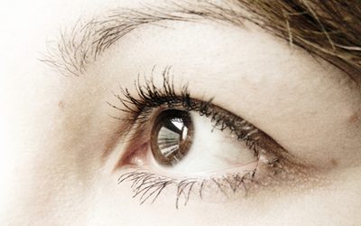 Choroidal Metastasis as the First Sign of Renal Cell Carcinoma: Case Report
