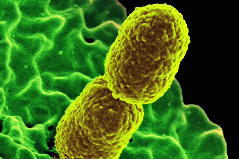 In silico Analysis of CRISPR-Cas System in Klebsiella Species