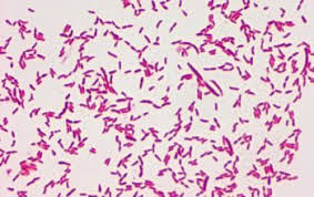 Identification and Secondary Structural Investigation of Pseudomonas Putida Strain TB3 Signatures Based on 16S Rrna Gene Obtained From Kolanut Husk