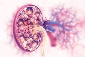 Premature Aging & Senescence in Kidney Fibrosis