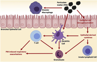 Toxicology of the Immune System and Systems Biology