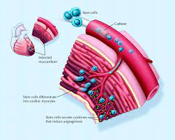 Exercise and Stem Cell Therapeutics for the Infarcted Heart