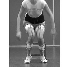 Relationship between Lower Limb EMG Activity and Knee Frontal Plane Projection Angle during a Single-Legged Drop Jump