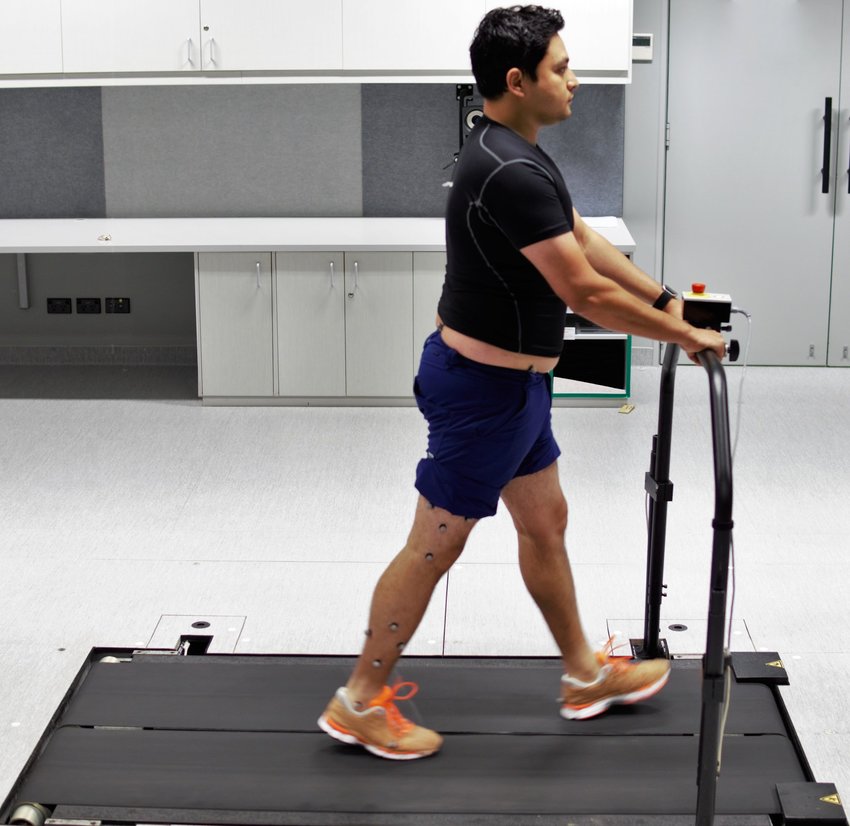 Changes in Lower Limb Muscle Activity after Walking on a Split Belt Treadmill