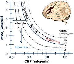 Nonstationarity of Dynamic Cerebral Autoregulation